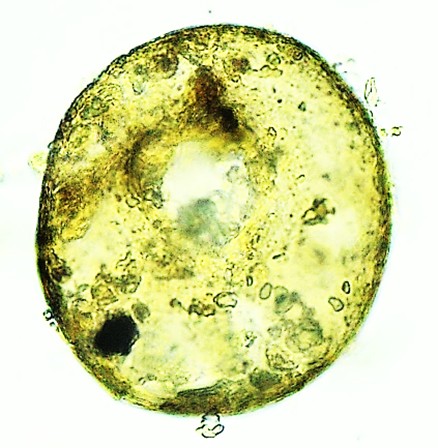CEN-sp 15-A