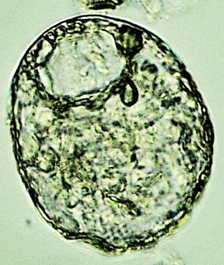 CEN-sp3-B