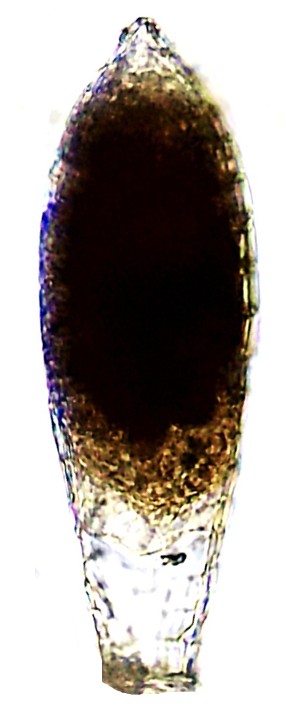 MRA sp 1-D